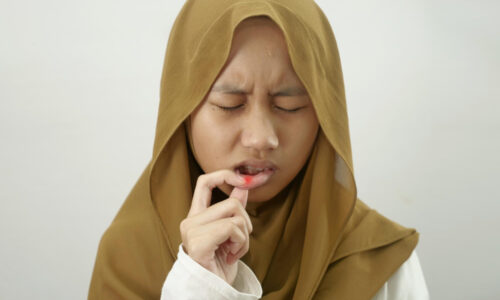 sariawan pada anak gadis